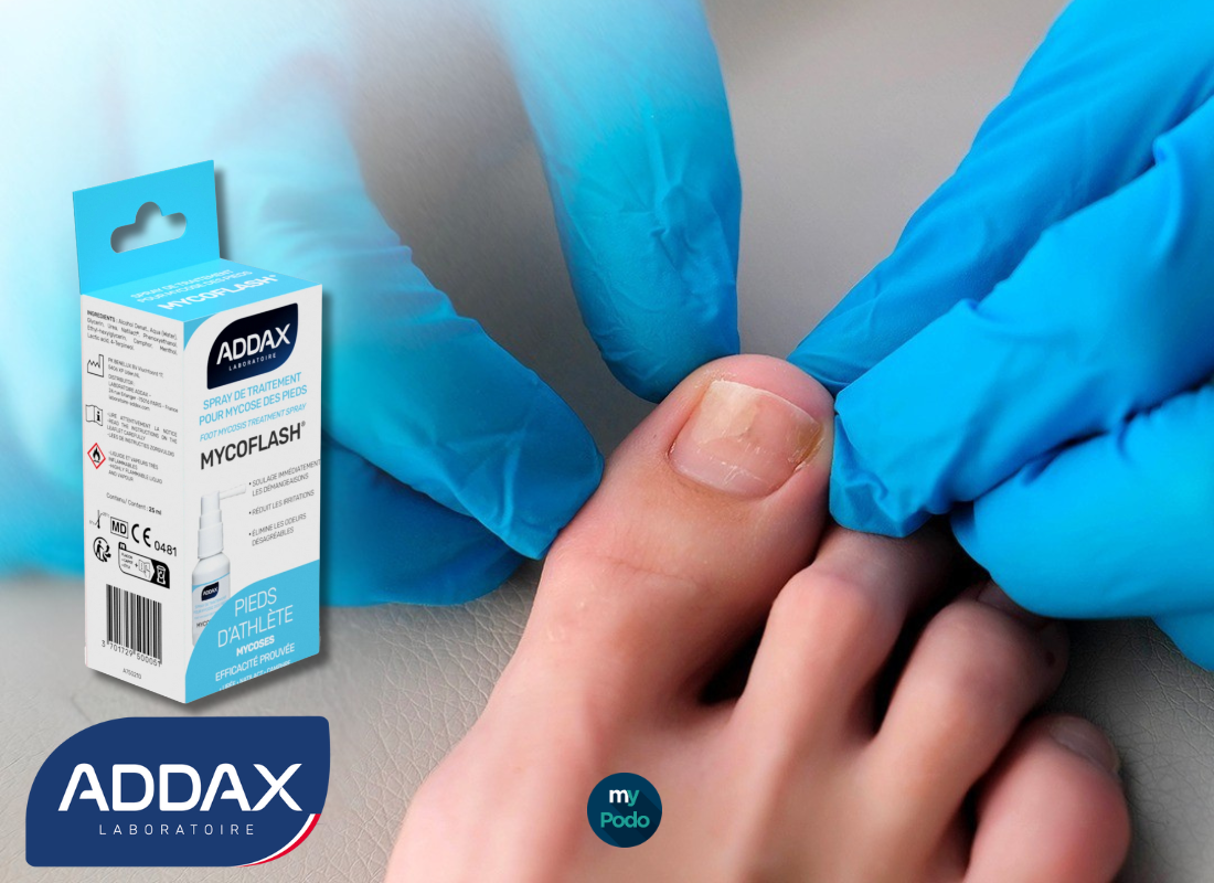 Mycoses des ongles : Laboratoire Addax, grand gagnant selon ALLOPODO ! - My Podologie