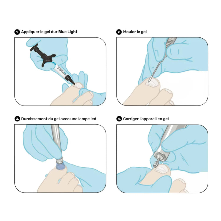 Lampe LED professionnelle - Blue Light - Ruck - My Podologie