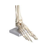Nivelletyn jalan luuranko - My Podiatry